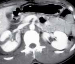 urologische traumata 1