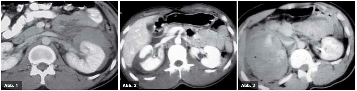 urologische traumata 2